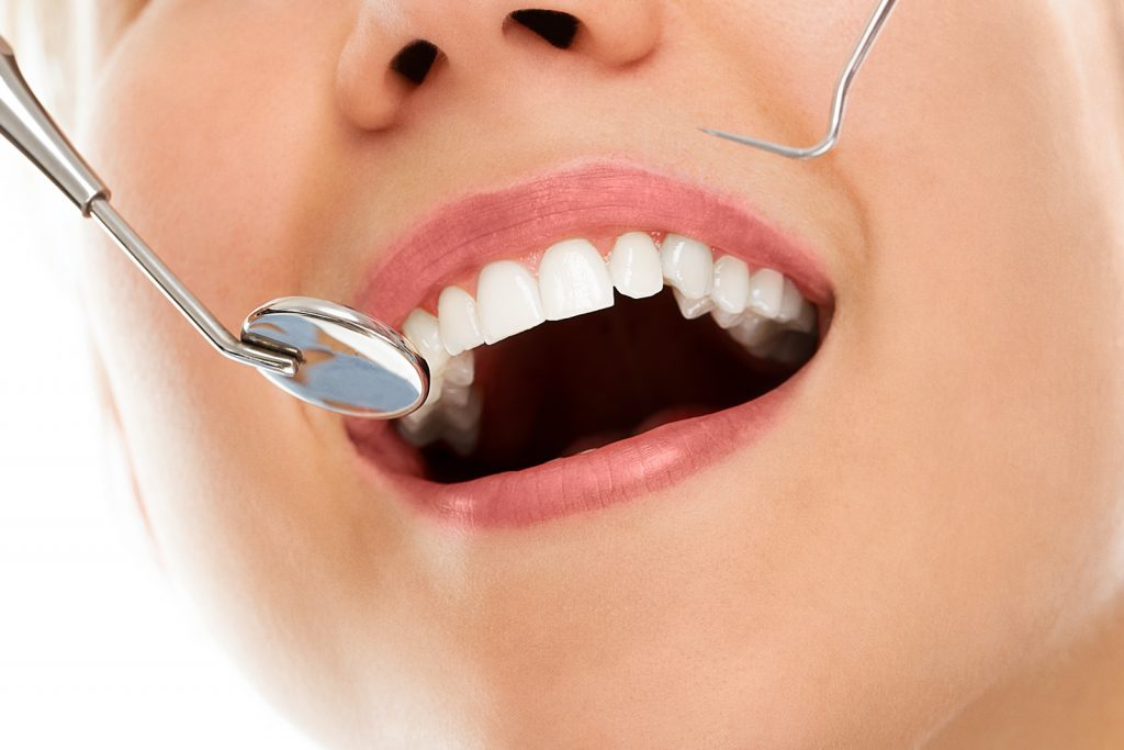 Das Bild zeigt eine Prophylaxe Untersuchung mit Zahnarzt Spiegel.